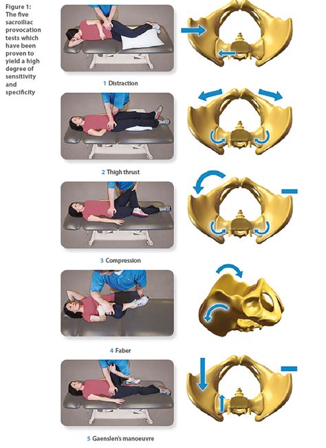 sacroiliac provocative testing